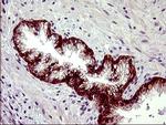 PDGFRB Antibody in Immunohistochemistry (Paraffin) (IHC (P))