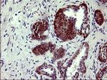 PDGFRB Antibody in Immunohistochemistry (Paraffin) (IHC (P))