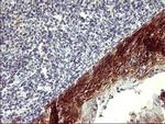 PDGFRB Antibody in Immunohistochemistry (Paraffin) (IHC (P))