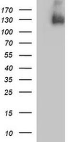 PDGFRB Antibody in Western Blot (WB)