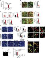 CD140b (PDGFRB) Antibody in Immunohistochemistry (Frozen) (IHC (F))