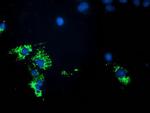 PDHA1 Antibody in Immunocytochemistry (ICC/IF)