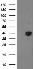 PDHA1 Antibody in Western Blot (WB)