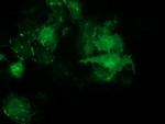 PDLIM2 Antibody in Immunocytochemistry (ICC/IF)