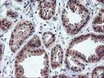 PDLIM2 Antibody in Immunohistochemistry (Paraffin) (IHC (P))