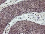 PDLIM2 Antibody in Immunohistochemistry (Paraffin) (IHC (P))