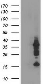 PDLIM2 Antibody in Western Blot (WB)