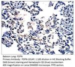 Podoplanin Antibody in Immunohistochemistry (IHC)