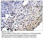 Podoplanin Antibody in Immunohistochemistry (IHC)