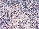 PDSS2 Antibody in Immunohistochemistry (Paraffin) (IHC (P))