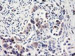 PDSS2 Antibody in Immunohistochemistry (Paraffin) (IHC (P))