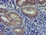 PDSS2 Antibody in Immunohistochemistry (Paraffin) (IHC (P))