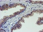 PDSS2 Antibody in Immunohistochemistry (Paraffin) (IHC (P))