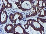 PDSS2 Antibody in Immunohistochemistry (Paraffin) (IHC (P))