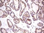 PDSS2 Antibody in Immunohistochemistry (Paraffin) (IHC (P))