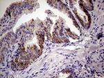 PDSS2 Antibody in Immunohistochemistry (Paraffin) (IHC (P))