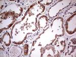 PDSS2 Antibody in Immunohistochemistry (Paraffin) (IHC (P))