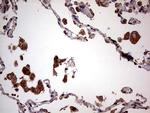 PDSS2 Antibody in Immunohistochemistry (Paraffin) (IHC (P))