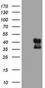 PDSS2 Antibody in Western Blot (WB)