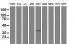 PDSS2 Antibody in Western Blot (WB)