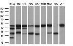 PDSS2 Antibody in Western Blot (WB)