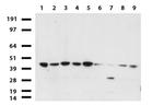 PDSS2 Antibody in Western Blot (WB)