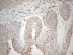 PDX1 Antibody in Immunohistochemistry (Paraffin) (IHC (P))