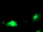 PDXK Antibody in Immunocytochemistry (ICC/IF)