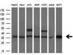 PDXK Antibody in Western Blot (WB)