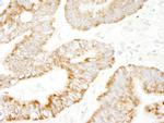 PDZ-GEF1 Antibody in Immunohistochemistry (IHC)