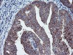 PECI Antibody in Immunohistochemistry (Paraffin) (IHC (P))