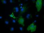 PECR Antibody in Immunocytochemistry (ICC/IF)