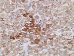 PECR Antibody in Immunohistochemistry (Paraffin) (IHC (P))