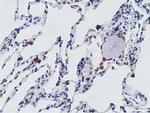 PECR Antibody in Immunohistochemistry (Paraffin) (IHC (P))