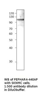 Phospho-Eph receptor A4 (Tyr596) Antibody in Western Blot (WB)