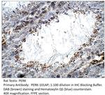 PERK Antibody in Immunohistochemistry (IHC)