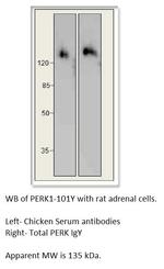 PERK Antibody in Western Blot (WB)