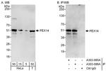 PEX14 Antibody in Western Blot (WB)