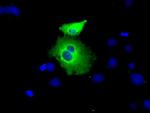 PEX5 Antibody in Immunocytochemistry (ICC/IF)