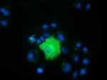 PEX5 Antibody in Immunocytochemistry (ICC/IF)