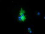 PEX5 Antibody in Immunocytochemistry (ICC/IF)