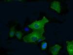 PFKFB4 Antibody in Immunocytochemistry (ICC/IF)