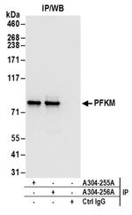 PFKM Antibody in Western Blot (WB)