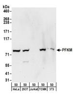 PFKM Antibody in Western Blot (WB)