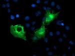 PFKP Antibody in Immunocytochemistry (ICC/IF)