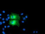 PFKP Antibody in Immunocytochemistry (ICC/IF)