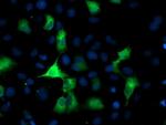 PFKP Antibody in Immunocytochemistry (ICC/IF)