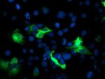 PFKP Antibody in Immunocytochemistry (ICC/IF)