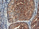 PFKP Antibody in Immunohistochemistry (Paraffin) (IHC (P))