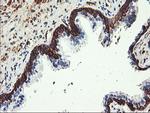 PFKP Antibody in Immunohistochemistry (Paraffin) (IHC (P))